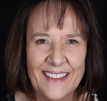 Smile Gallery - Church Road Dental and Cosmetic