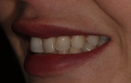 Smile Gallery - Church Road Dental and Cosmetic