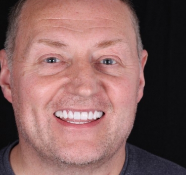 Smile Gallery - Church Road Dental and Cosmetic