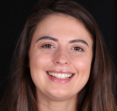 Smile Gallery - Church Road Dental and Cosmetic