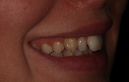 Smile Gallery - Church Road Dental and Cosmetic