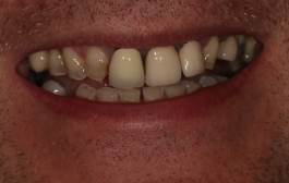 Smile Gallery - Church Road Dental and Cosmetic