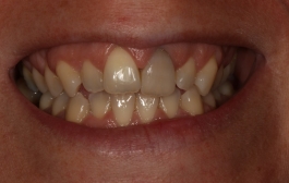 Smile Gallery - Church Road Dental and Cosmetic