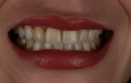 Smile Gallery - Church Road Dental and Cosmetic