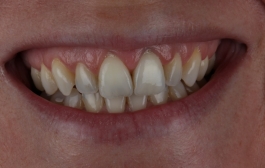 Smile Gallery - Church Road Dental and Cosmetic