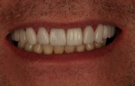 Smile Gallery - Church Road Dental and Cosmetic