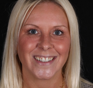 Smile Gallery - Church Road Dental and Cosmetic