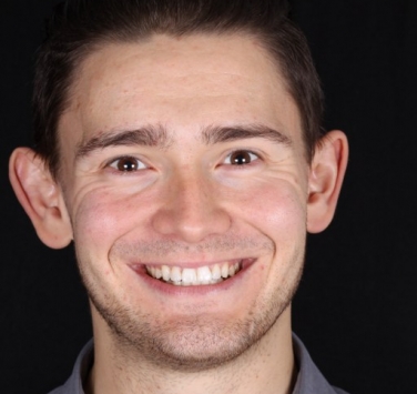 Smile Gallery - Church Road Dental and Cosmetic