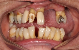 Smile Gallery - Church Road Dental and Cosmetic