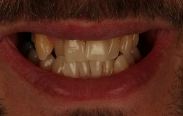 Smile Gallery - Church Road Dental and Cosmetic