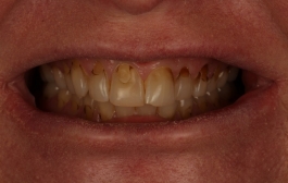 Smile Gallery - Church Road Dental and Cosmetic