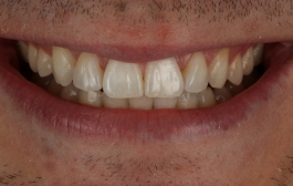 Smile Gallery - Church Road Dental and Cosmetic