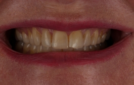 Smile Gallery - Church Road Dental and Cosmetic