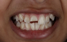 Smile Gallery - Church Road Dental and Cosmetic