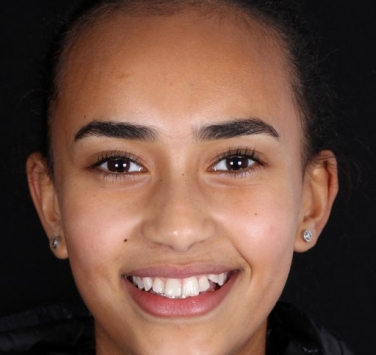 Smile Gallery - Church Road Dental and Cosmetic