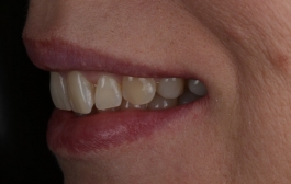 Smile Gallery - Church Road Dental and Cosmetic