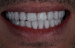 Smile Gallery - Church Road Dental and Cosmetic