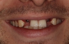 Smile Gallery - Church Road Dental and Cosmetic