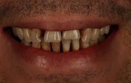 Smile Gallery - Church Road Dental and Cosmetic