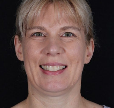 Smile Gallery - Church Road Dental and Cosmetic