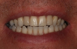 Smile Gallery - Church Road Dental and Cosmetic