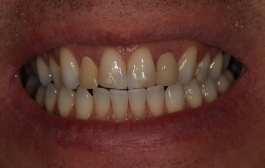 Smile Gallery - Church Road Dental and Cosmetic
