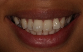 Smile Gallery - Church Road Dental and Cosmetic
