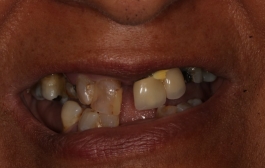 Smile Gallery - Church Road Dental and Cosmetic