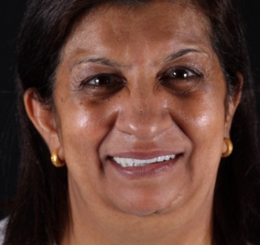 Smile Gallery - Church Road Dental and Cosmetic