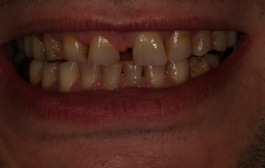 Smile Gallery - Church Road Dental and Cosmetic