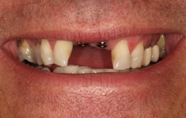 Smile Gallery - Church Road Dental and Cosmetic