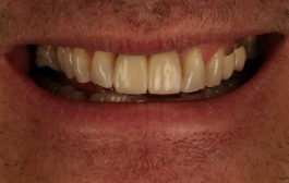 Smile Gallery - Church Road Dental and Cosmetic