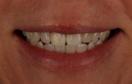 Smile Gallery - Church Road Dental and Cosmetic