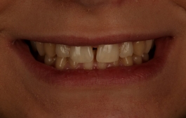 Smile Gallery - Church Road Dental and Cosmetic