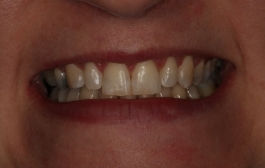 Smile Gallery - Church Road Dental and Cosmetic