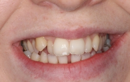 Smile Gallery - Church Road Dental and Cosmetic