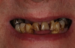 Smile Gallery - Church Road Dental and Cosmetic