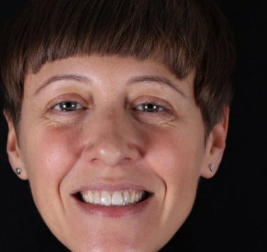 Smile Gallery - Church Road Dental and Cosmetic
