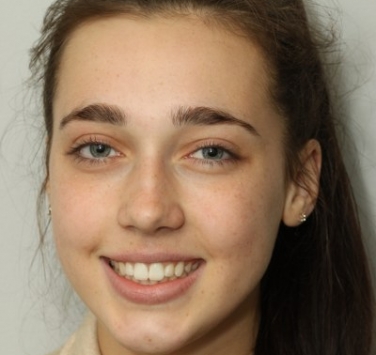 Smile Gallery - Church Road Dental and Cosmetic