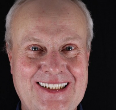 Smile Gallery - Church Road Dental and Cosmetic
