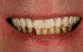 Smile Gallery - Church Road Dental and Cosmetic