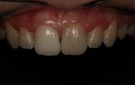Smile Gallery - Church Road Dental and Cosmetic