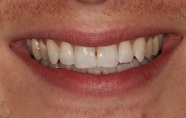 Smile Gallery - Church Road Dental and Cosmetic