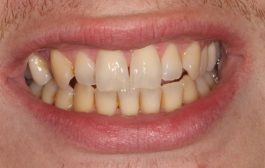 Smile Gallery - Church Road Dental and Cosmetic