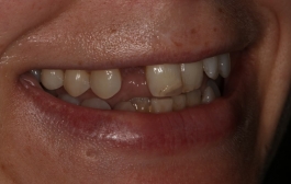 Smile Gallery - Church Road Dental and Cosmetic