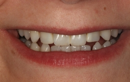 Smile Gallery - Church Road Dental and Cosmetic