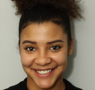 Smile Gallery - Church Road Dental and Cosmetic