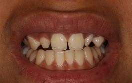 Smile Gallery - Church Road Dental and Cosmetic