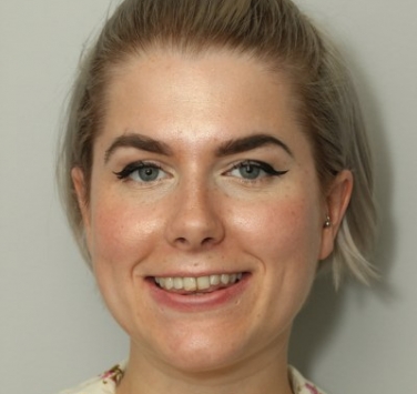 Smile Gallery - Church Road Dental and Cosmetic