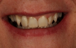 Smile Gallery - Church Road Dental and Cosmetic